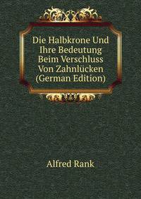 Die Halbkrone Und Ihre Bedeutung Beim Verschluss Von Zahnlucken (German Edition)