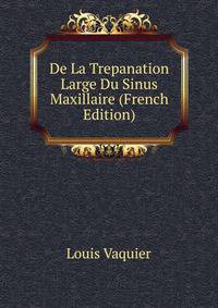 De La Trepanation Large Du Sinus Maxillaire (French Edition)