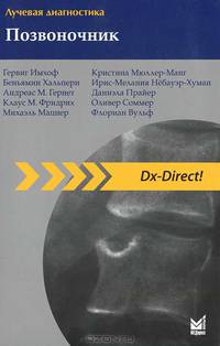Лучевая диагностика. Позвоночник