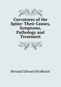 Curvatures of the Spine: Their Causes, Symptoms, Pathology and Treatment
