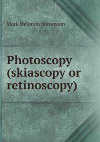 Photoscopy (skiascopy or retinoscopy)
