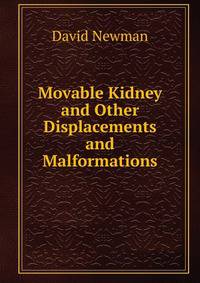 Movable Kidney and Other Displacements and Malformations