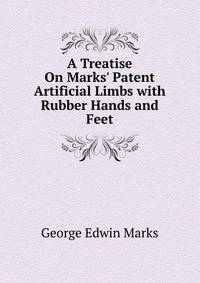A Treatise On Marks' Patent Artificial Limbs with Rubber Hands and Feet