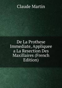 De La Prothese Immediate, Appliquee a La Resection Des Maxillaires (French Edition)