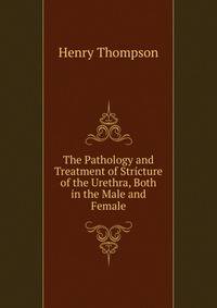 The Pathology and Treatment of Stricture of the Urethra, Both in the Male and Female