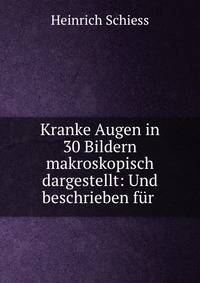 Kranke Augen in 30 Bildern makroskopisch dargestellt: Und beschrieben fur .