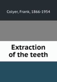 Extraction of the teeth