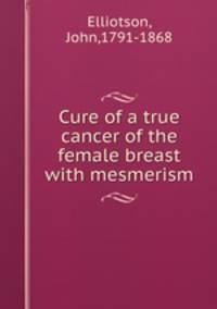 Cure of a true cancer of the female breast with mesmerism