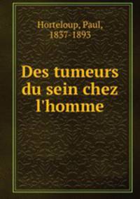 Des tumeurs du sein chez l`homme