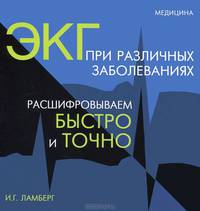 ЭКГ при различных заболеваниях. Расшифровываем быстро и точно. 2-е изд