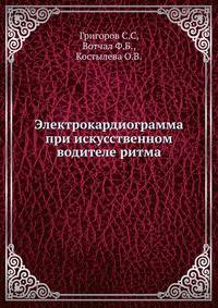Электрокардиограмма при искусственном водителе ритма