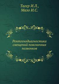 Рентгенодиагностика смещений поясничных позвонков