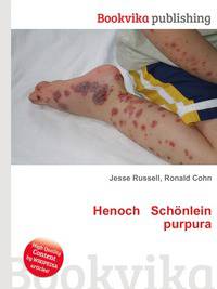 Henoch Schonlein purpura