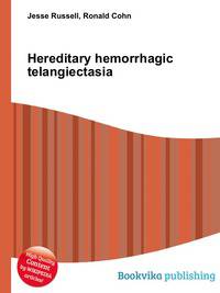 Hereditary hemorrhagic telangiectasia