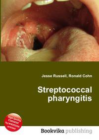 Streptococcal pharyngitis