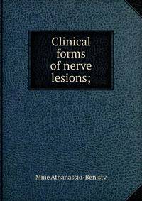 Clinical forms of nerve lesions;