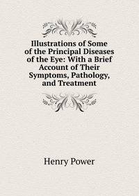 Illustrations of Some of the Principal Diseases of the Eye: With a Brief Account of Their Symptoms, Pathology, and Treatment