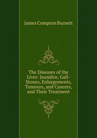 The Diseases of the Liver: Jaundice, Gall-Stones, Enlargements, Tumours, and Cancers, and Their Treatment