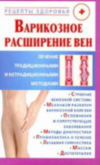 Варикозное расширение вен. Лечение традиционными и нетрадиционными методами