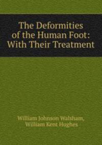 The Deformities of the Human Foot: With Their Treatment