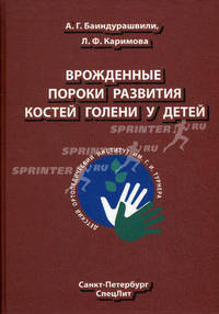 Врожденные пороки развития костей голени у детей
