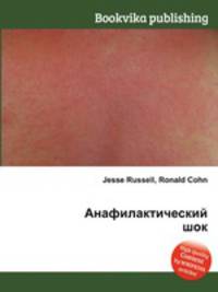 Анафилактический шок