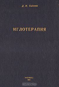 Иглотерапия