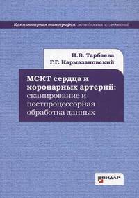 МСКТ сердца и коронарных артерий: сканироввание и постпроцессорная обработка данных