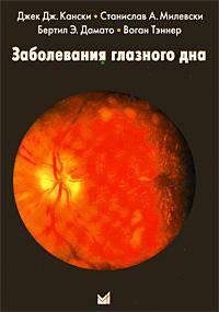 Заболевания глазного дна