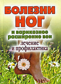 Болезни ног и варикозное расширение вен. Лечение и профилактика.