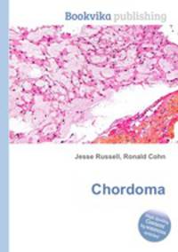 Chordoma