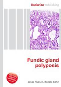 Fundic gland polyposis