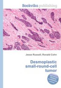 Desmoplastic small-round-cell tumor