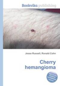 Cherry hemangioma