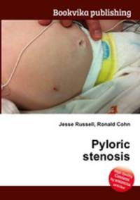 Pyloric stenosis