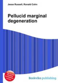 Pellucid marginal degeneration