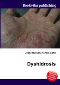 Dyshidrosis
