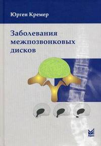 Заболевания межпозвонковых дисков