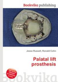 Palatal lift prosthesis