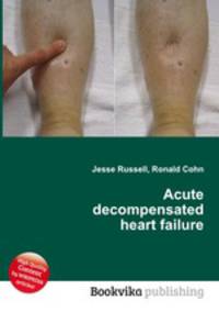Acute decompensated heart failure