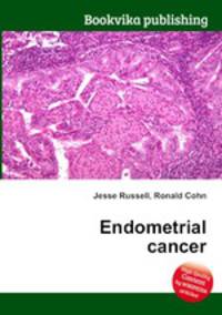 Endometrial cancer