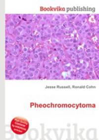 Pheochromocytoma