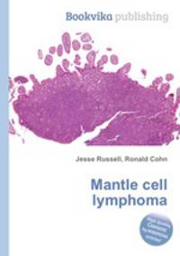 Mantle cell lymphoma