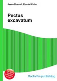 Pectus excavatum