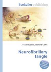 Neurofibrillary tangle