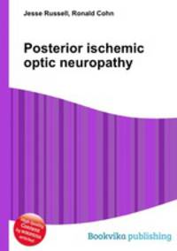 Posterior ischemic optic neuropathy
