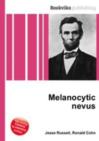 Melanocytic nevus