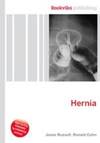 Hernia