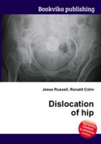 Dislocation of hip