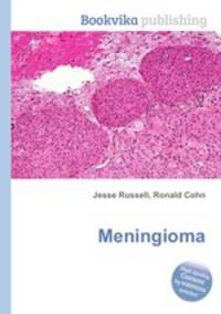 Meningioma